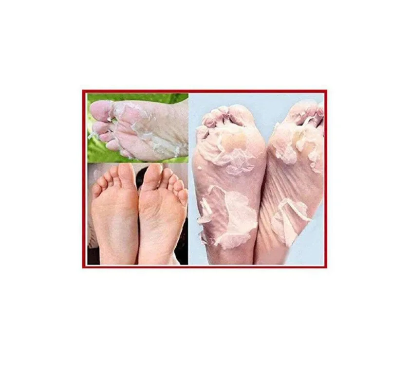ماسك القدم (الكوري)  Exfoliating Foot Mask