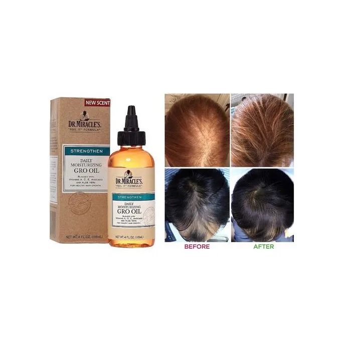 دكتور ميركل  جرو أويل زيت الترطيب اليومي لنمو الشعر وتقوية فروة الرأس 118 مل  ا Dr. Miracle's Daily Moisturizing Gro Oil for Hair Growth & Scalp Care – 118ml