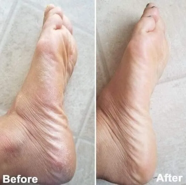 فارم ستاي كريم القدمين بالليمون المرطب | Farm Stay lemon intensive moisture foot