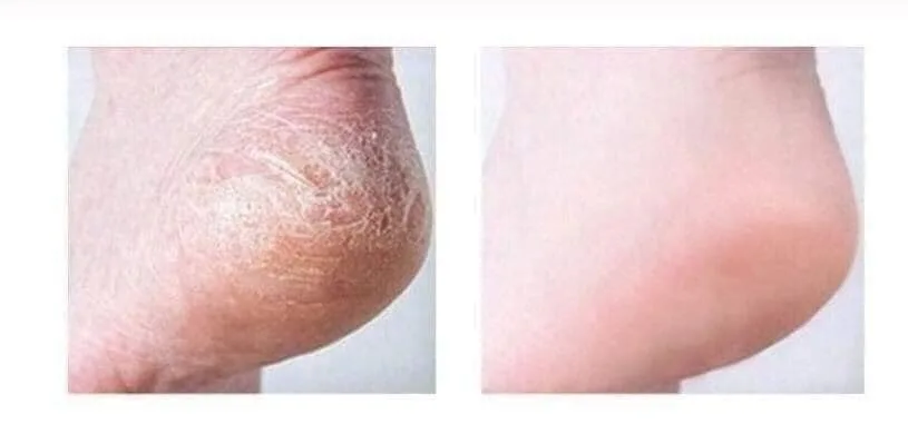 فارم ستاي كريم القدمين بالليمون المرطب | Farm Stay lemon intensive moisture foot