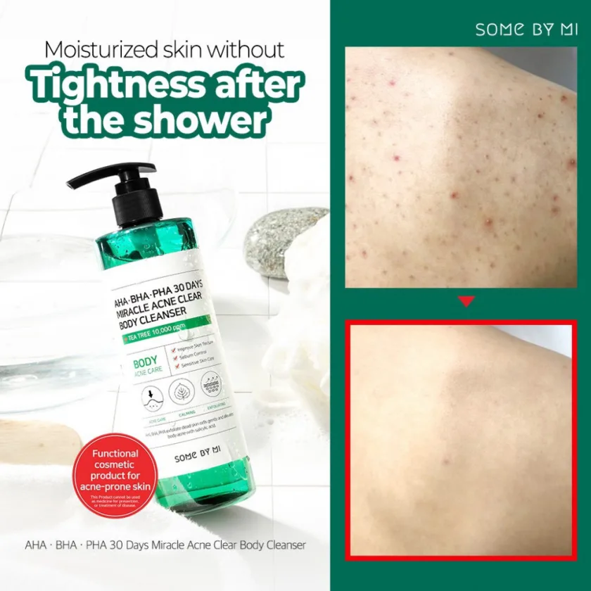 سام باي مي غسول جسم أحماض التقشير المعجزة لعلاج الحبوب 400 جرام   |   SOME BY MI AHA.BHA.PHA 30 Days Miracle Clear Body Cleanser 400g