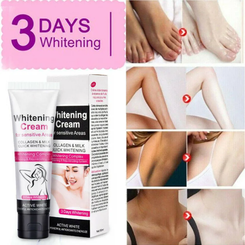 كريم ايتشن بيوتي لتفتيح المناطق الحساسة  50 جم  |  Aichun Beauty Whitening Cream For Sensitive Area 50 g