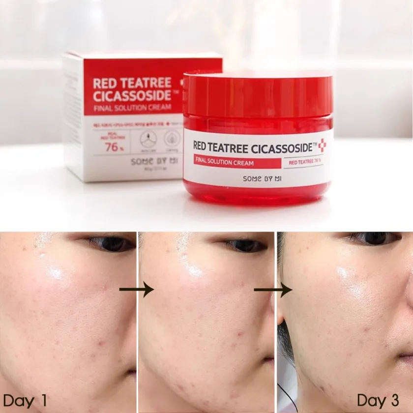 سام باي مي كريم سيكاسوسيد بخلاصة شجرة الشاي الأحمر 60 جم | SOME BY MI Red Tea Tree Cicassoside Final Solution Cream 60g