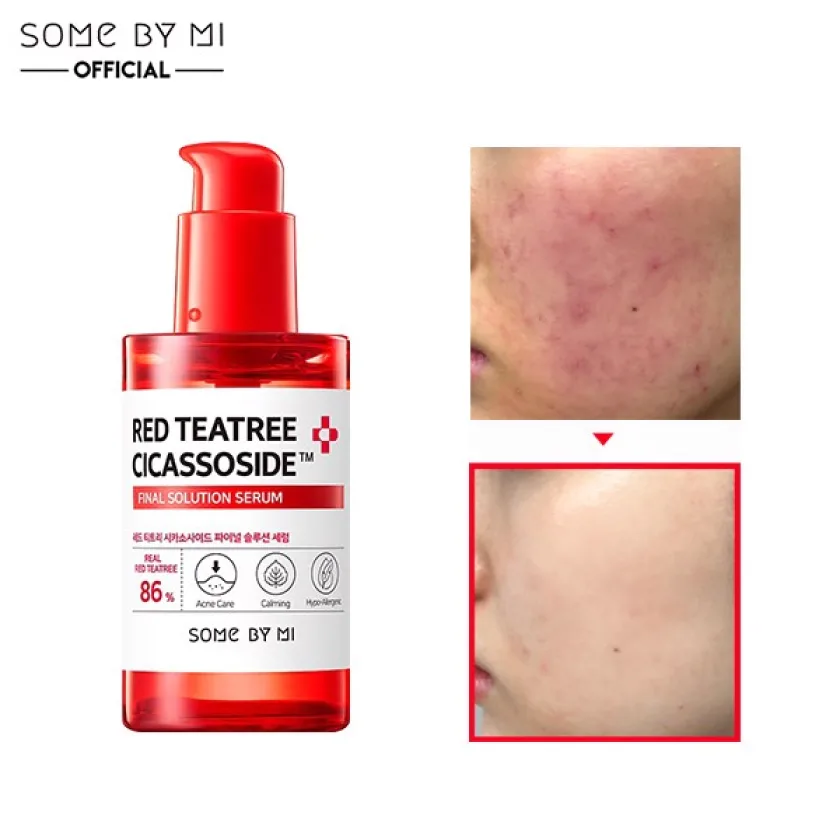 سام باي مي سيروم ديرما سيكاسوسيد بخلاصة شجرة الشاي الأحمر 50 مل | SOME BY MI Red Tea Tree Cicassoside Derma Solution Serum 50ml