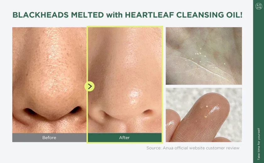 انوا هارت غسول الهارت ليف الزيتي للتحكم في المسام ، 200مل | Anua Heartleaf Pore Control Cleansing Oil Korean Facial Cleanser  200ml