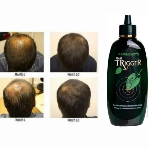 كامينوموتو تريجر محفز خروج بصيلات الشعر و معالج الصلع 180 مل  |  Kaminomoto Trigger Hair Growth 180ml