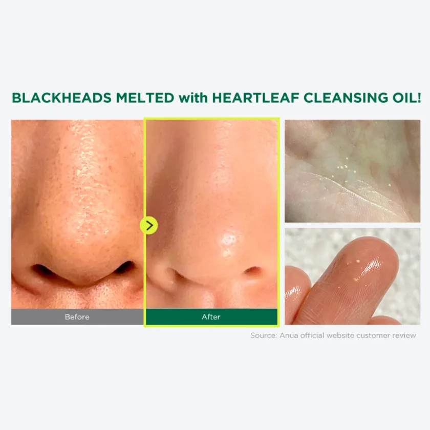 أنوا هارت غسول الهارت ليف الزيتي للتحكم في المسام ، 20مل ميني | Anua Heartleaf Pore Control Cleansing Oil Korean Facial Cleanser  20ml mini