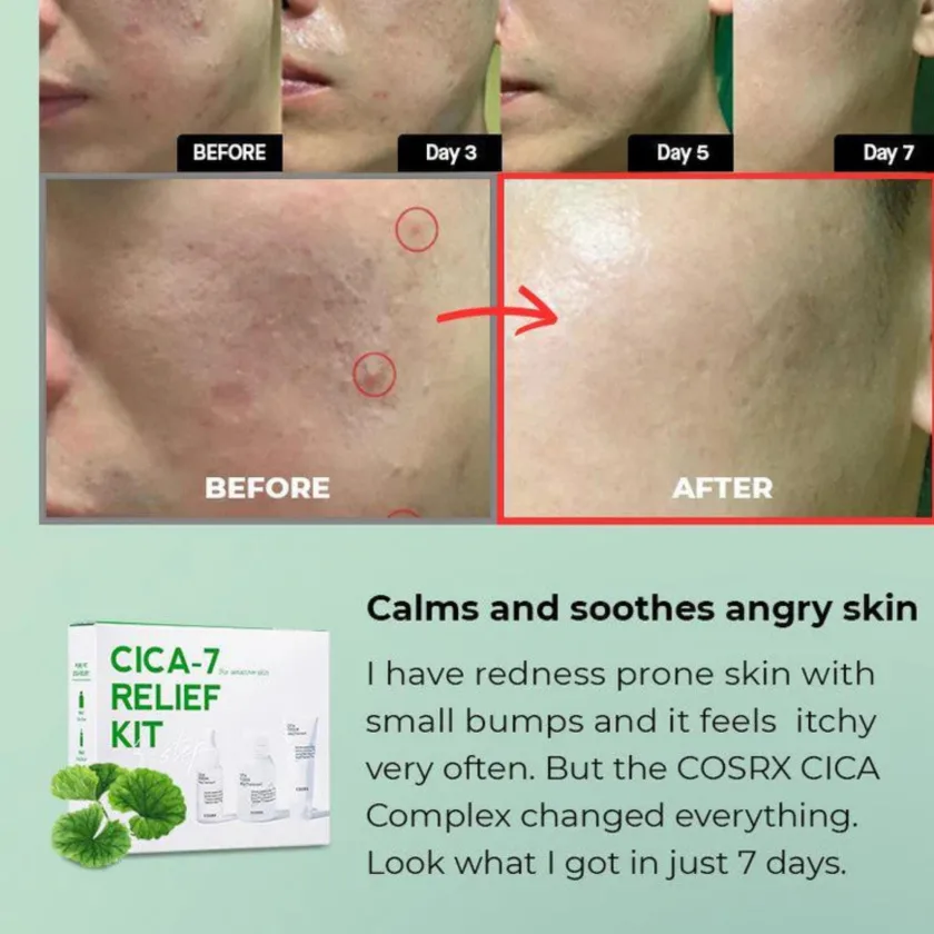 مجموعة كوزركس سيسا 7 ريليف للعناية وتهدئة البشرة الحساسة | COSRX Cica-7 Relief Kit