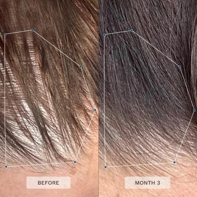 هير بيرست 60 كبسولة | Hair Burst 60 Capsules