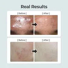 نومبوزين رقم 1 تونر مهدئ بالأعشاب النقية الكاملة 300 مل |  Numbuzin No.1 Pure-full Calming Herb Toner 300ml