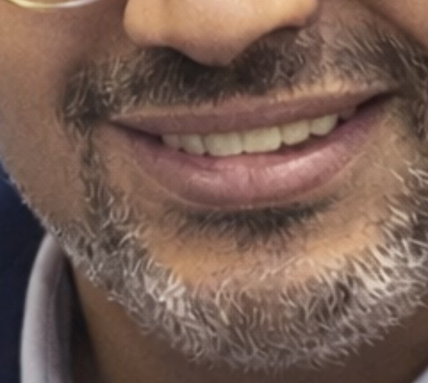 10300 Zero حجم 10 بوصه