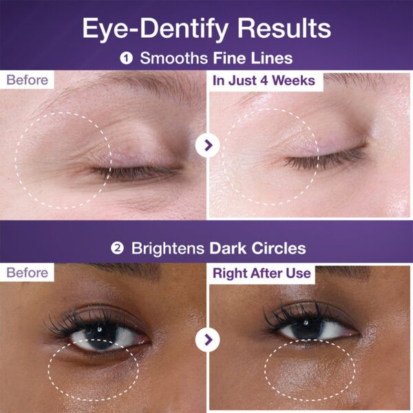 نومبوزين رقم 9 – لاصقات NAD+ والكولاجين للعناية بمنطقة حول العين 5 قطع | numbuzin No.9 NAD+ Collagen Under Eye Patches 5ea