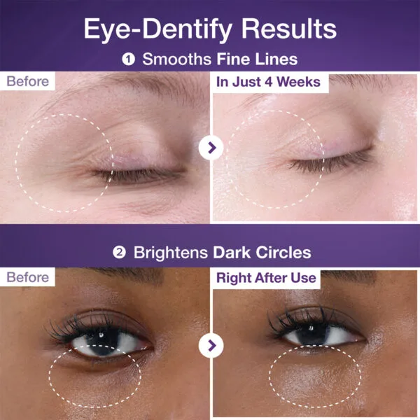 نومبوزين رقم 9 لاصقات NAD+ والكولاجين للعناية بمنطقة حول العين 5 قطع | numbuzin No.9 NAD+ Collagen Under Eye Patches 5 ea