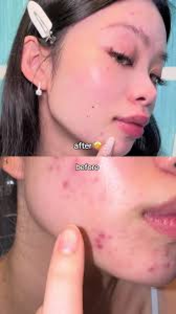 بوريتو – سيروم معزز بتركيبة ثلاثية المفعول للعناية بالبشرة 30 مل | Purito TXA 6 Niacinamide 10 Retinal Booster Serum 30ml