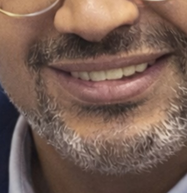 مكنة فيشار صحية