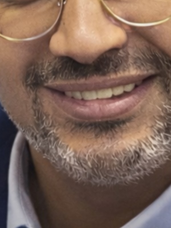 مكنة فيشار صحية