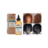 دكتور ميركل  جرو أويل زيت الترطيب اليومي لنمو الشعر وتقوية فروة الرأس 118 مل  ا Dr. Miracle's Daily Moisturizing Gro Oil for Hair Growth & Scalp Care – 118ml