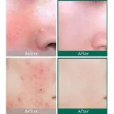 سام باي مي كريم ميركل لعلاج الحبوب وتهدئة البشرة 50 مل | SOME BY MI 30 Days Miracle Cream 50ml