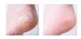 فارم ستاي كريم القدمين بالليمون المرطب | Farm Stay lemon intensive moisture foot