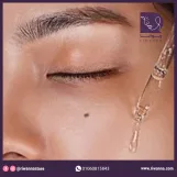 سام باي مي سيروم فيتامين سي لتفتيح وإشراقة البشرة 30 مل | SOME BY MI Galactomyces Pure Vitamin C Glow Serum 30ml