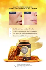تريزيا محلول جولد هوني الكل في واحد للتبييض ومضاد للتجاعيد - 230 ملل  |  Teresia Gold Honey All-In-One Whitening Anti-Wrinkle Ampoule Solution - 230 ml