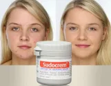 سودو كريم كريم معالج ومطهر 125 جم  |  Sudocrem Antiseptic Healing Cream 125g