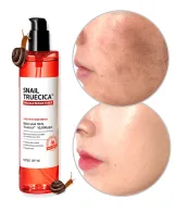 سام باي مي تونر سنيل تروسيكا ميراكل معالج للبشرة 135 مل | SOME BY MI Snail Truecica Miracle Repair Toner 135ml