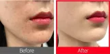 سام باي مي تونر سيكاسوسيد بخلاصة شجرة الشاي الأحمر لتهدئة البشرة 150 مل | SOME BY MI Red TeaTree Cicassoside Final Solution Toner 150ml