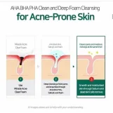 سام باي مي منظف الوجه الرغوي لحب الشباب المعجزة 30 يوماً 100 مل | SOME BY MI 30 Days Miracle Acne Clear Foam 100ml