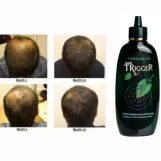 كامينوموتو تريجر محفز خروج بصيلات الشعر و معالج الصلع 180 مل  |  Kaminomoto Trigger Hair Growth 180ml