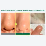 أنوا هارت غسول الهارت ليف الزيتي للتحكم في المسام ، 20مل ميني | Anua Heartleaf Pore Control Cleansing Oil Korean Facial Cleanser  20ml mini