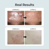 تونر نومبوزين رقم 1 المهدئ بالأعشاب النقية الكاملة |  Numbuzin No.1 Pure-full Calming Herb Toner 300ml