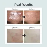نومبوزين رقم 1 تونر مهدئ بالأعشاب النقية الكاملة 300 مل |  Numbuzin No.1 Pure-full Calming Herb Toner 300ml