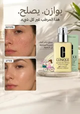 Clinique Dramatically Different Moisturizing Gel